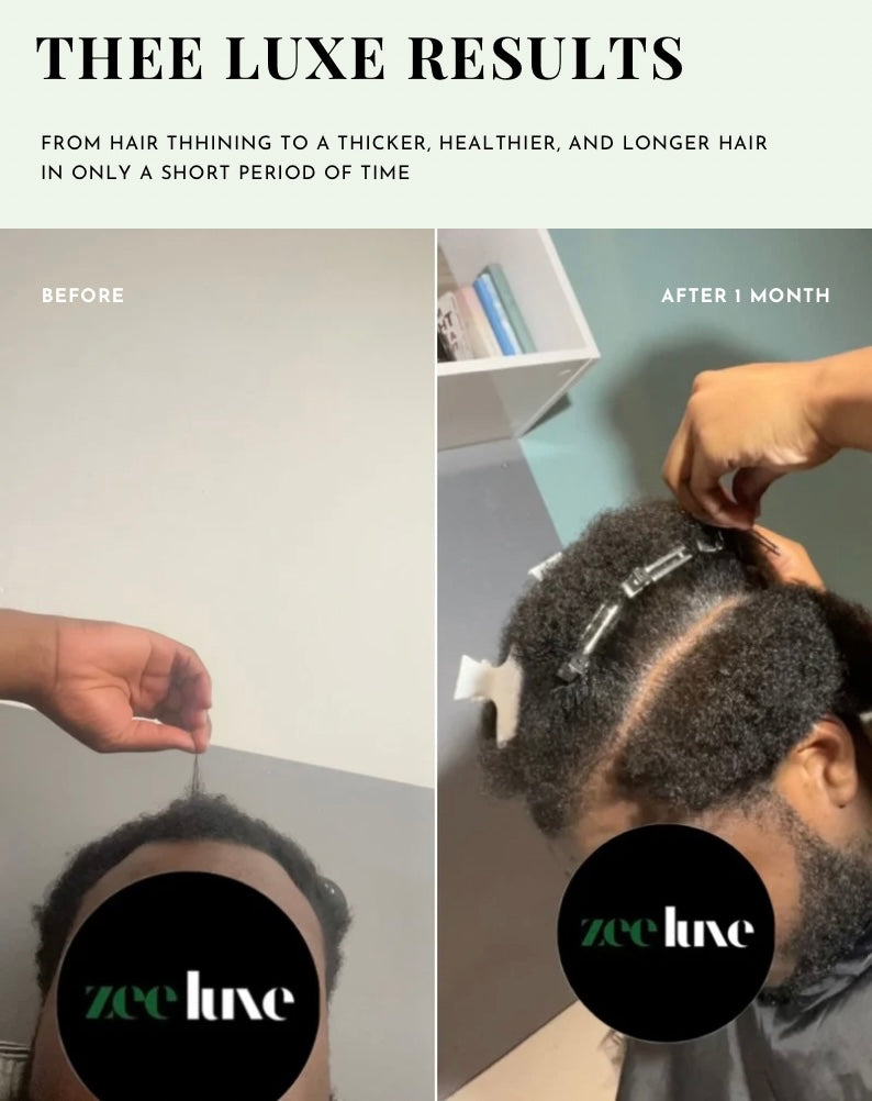 Thee Growth Serum