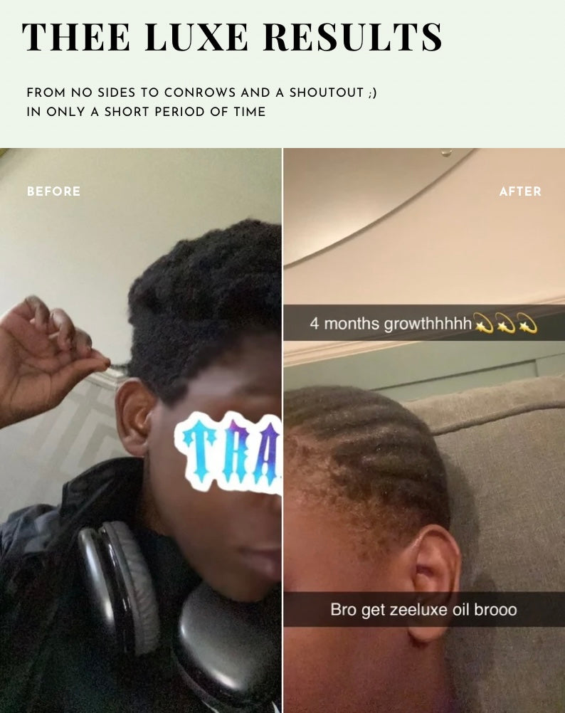 Thee Luxe Growth Package