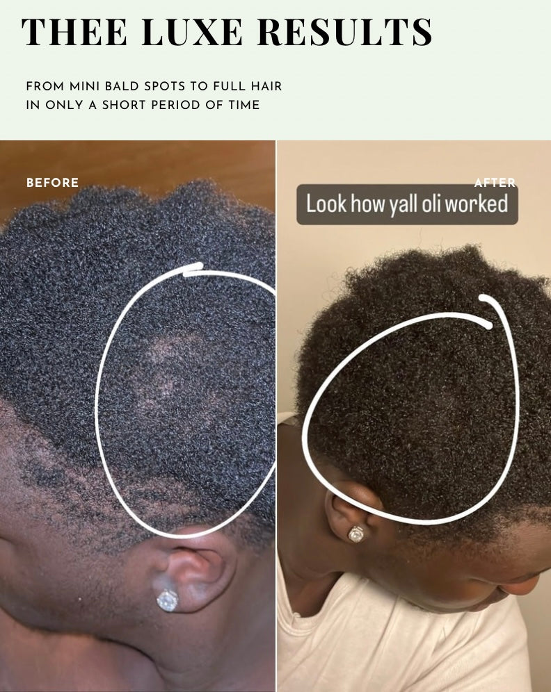 Thee Growth Serum